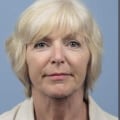What is the best laser for a 60 year old?