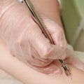 Can laser treatment be cancerous?