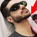 Is it safe to laser your neck?
