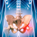 Is laser treatment good for hip pain?