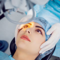 Who should not get laser treatment?