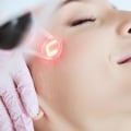 Little Downtime Required: The Advantages of Laser Skin Treatments