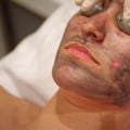 Is laser skin treatment healthy?