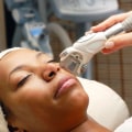 Which skin laser treatment is best?
