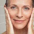 Everything You Need to Know About Fractional Laser Treatments