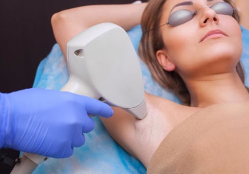 Can you get a fever from laser hair removal?