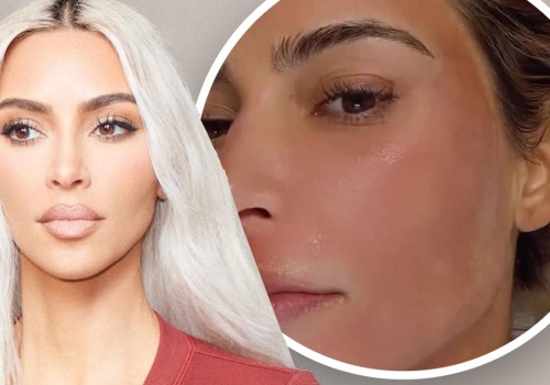 Does kim kardashian do fraxel?