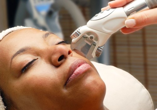 The Different Types of Laser Skin Treatments