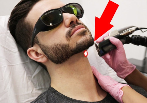 Is it safe to laser your neck?