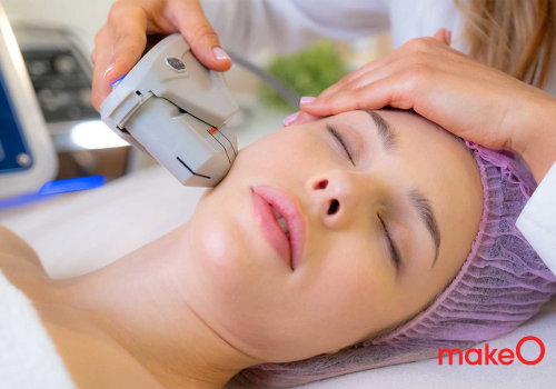 Is laser face treatment cost worth it?