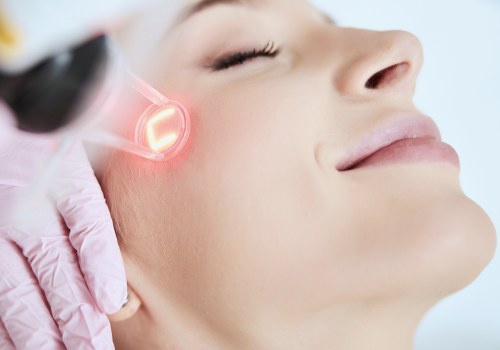 Little Downtime Required: The Advantages of Laser Skin Treatments
