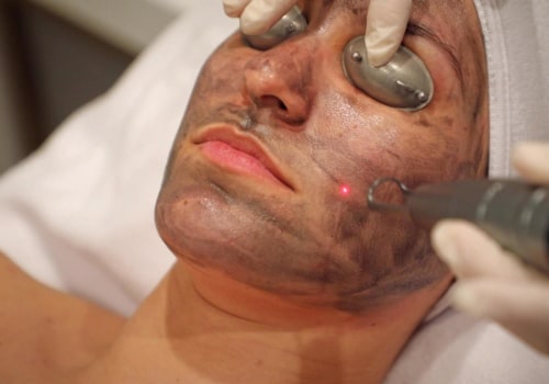 Is laser skin treatment healthy?