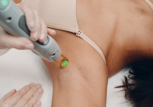 How much does it cost to do a laser?