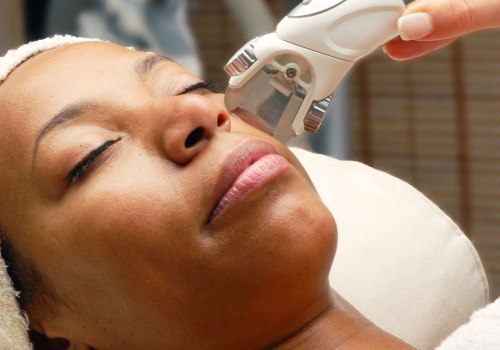 Which skin laser treatment is best?